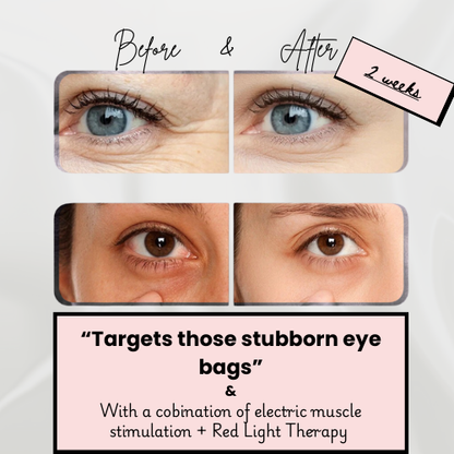 Revno™ Red Light Eye Massager