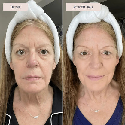 Revno™ Red Light Eye Massager